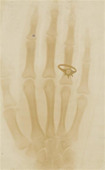 (X-RAYS) A small archive of 14 X-rays and related imagery documenting early use of the technology at Wesleyan University.